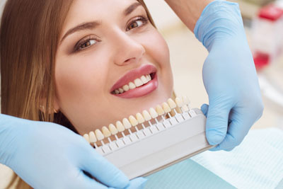 Dental Veneers