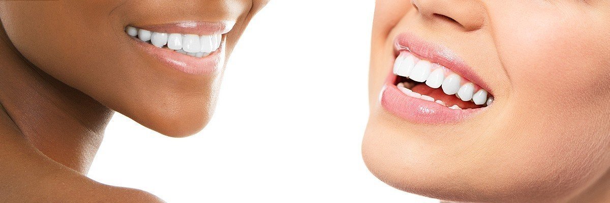 Cleburne Dental Restoration