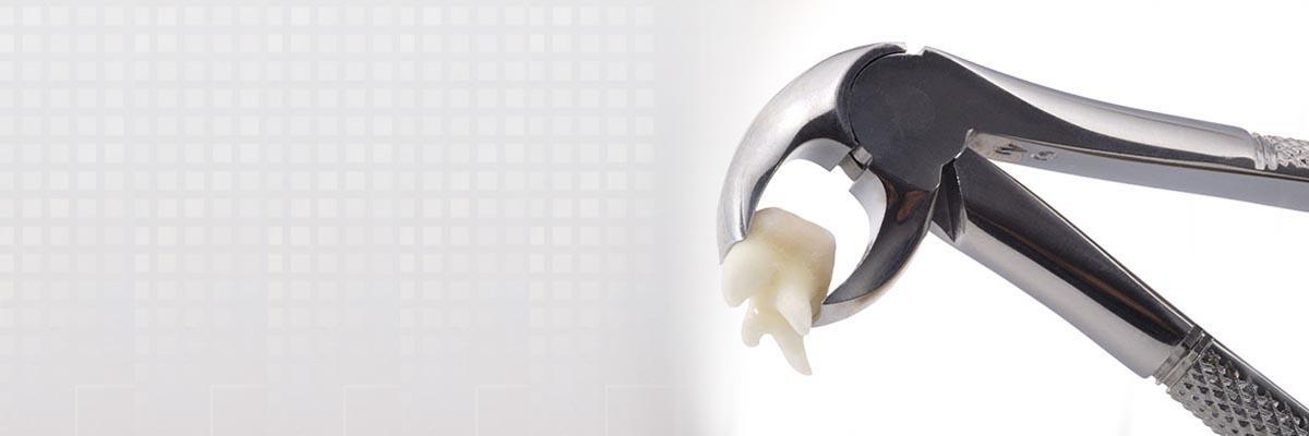 Cleburne Tooth Extraction